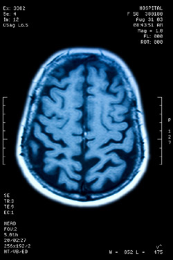 Brain Stem Death Testing