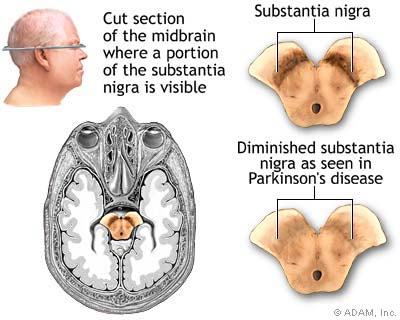 Brain Stem Death Testing