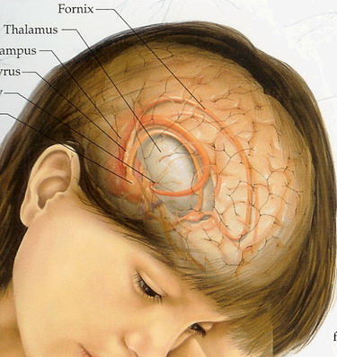 Brain Stem Glioma Symptoms