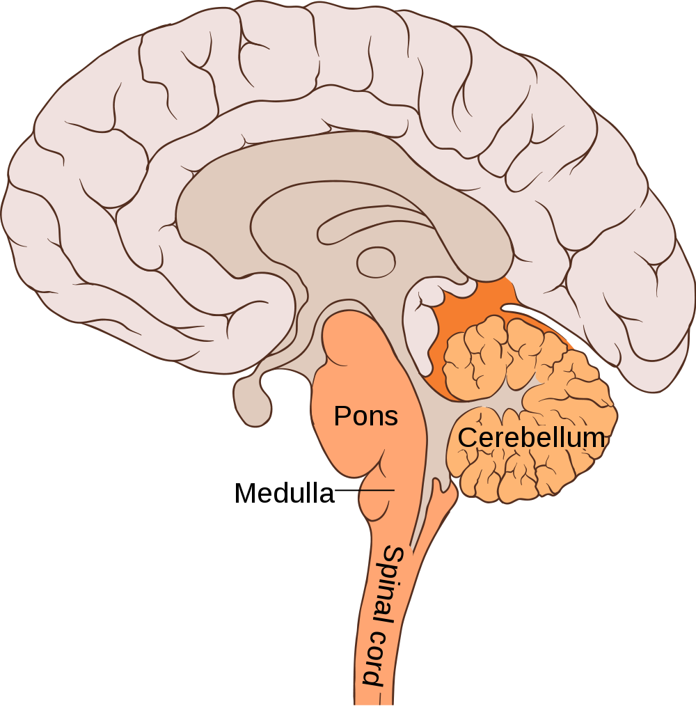 Brain Stem Glioma Treatment