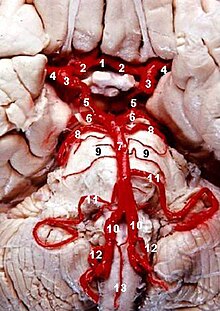 Brain Stem Stroke Icd 9