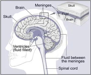 Brain Tumor