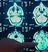 Brain Tumor Symptoms In Men