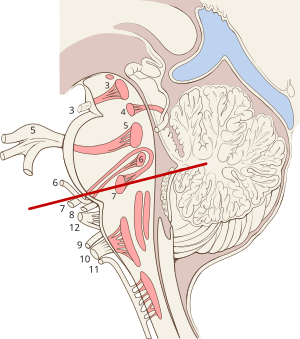 Brainstem Anatomy Mri