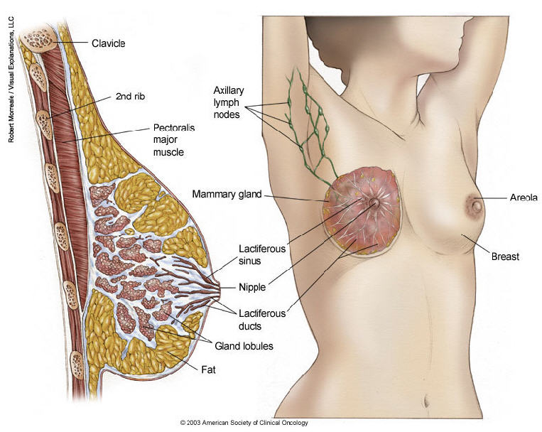 Breast Cancer Cells Diagram