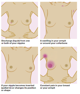 Breast Cancer Lump Pictures