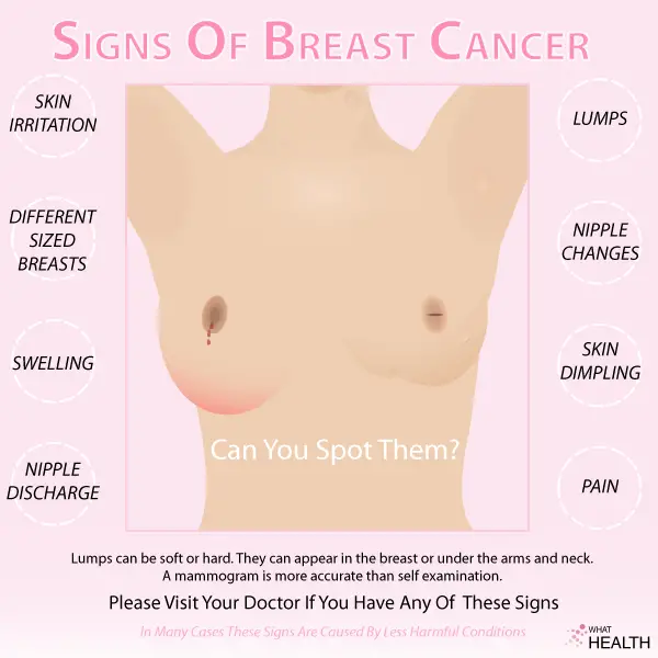 Breast Cancer Lump Symptoms