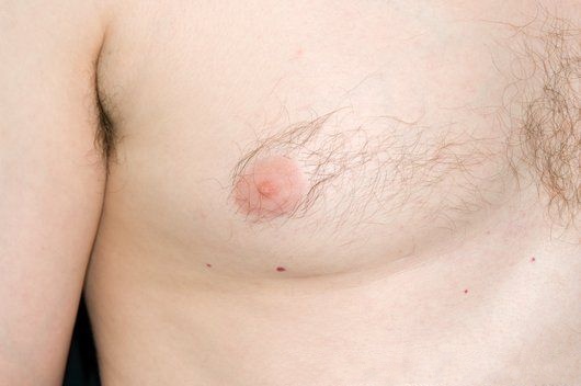 Breast Cancer Pictures In Men