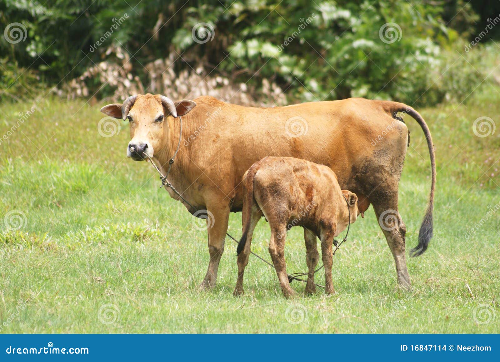 Breast Milk Color Yellow