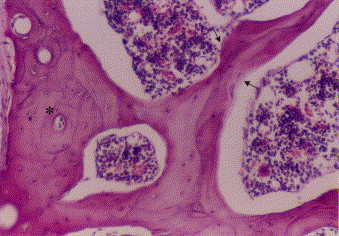 Compact Bone Histology Slides