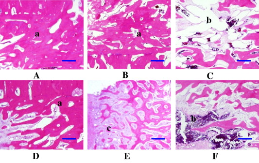 Compact Bone Histology Slides