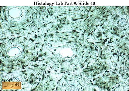 Compact Bone Histology Slides