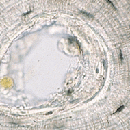 Compact Bone Tissue Function