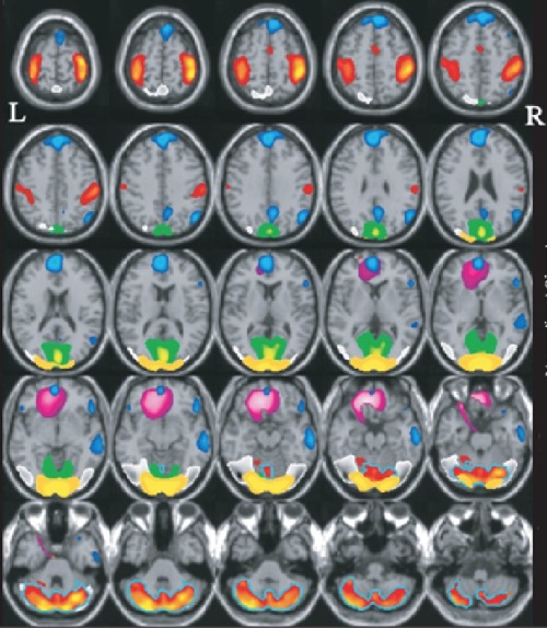 Different Regions Of The Brain