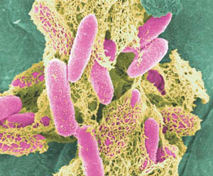 Escherichia Coli (e. Coli)