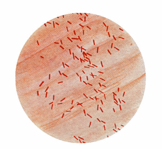 Escherichia Coli