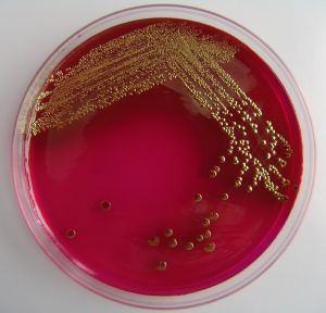 Escherichia Coli