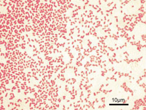 Escherichia Coli Gram Stain