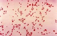 Escherichia Coli Gram Stain