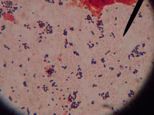 Escherichia Coli Gram Stain