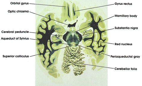 Frontal Lobe Anatomy