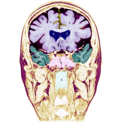 Frontal Lobe Anatomy Mri