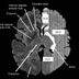 Frontal Lobe Anatomy Mri