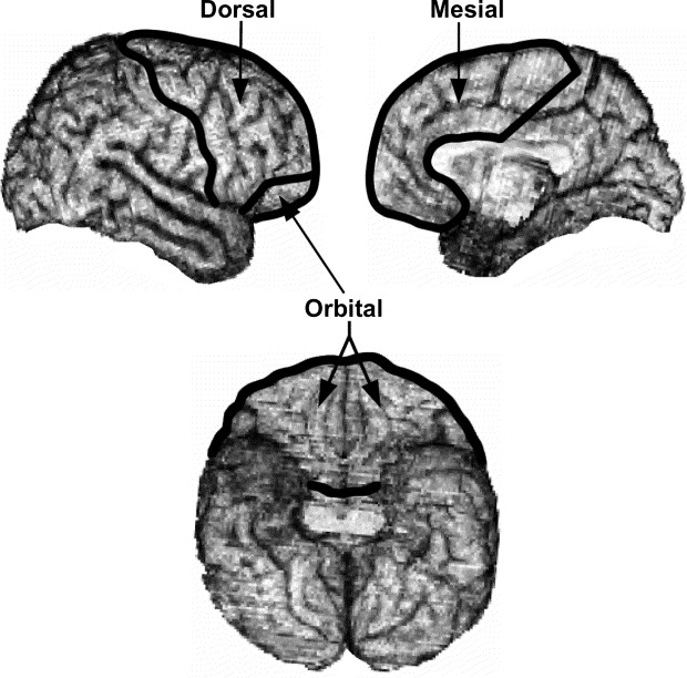 Frontal Lobe Anatomy Ppt