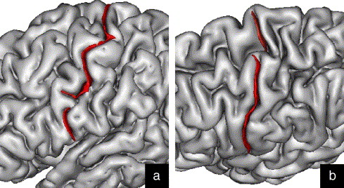 Frontal Lobe Anatomy Ppt