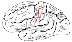 Frontal Lobe Damage Sociopath