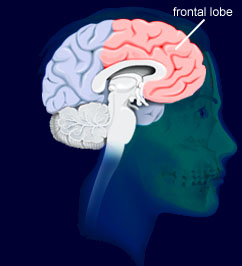 Frontal Lobe Damage Symptoms