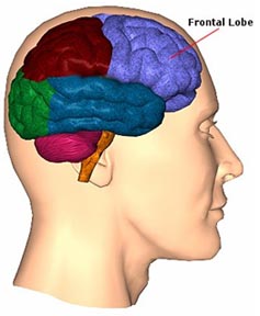 Frontal Lobe Dementia