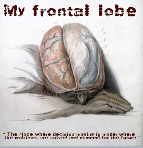 Frontal Lobe Syndrome