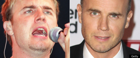 Gary Barlow Fat Pictures