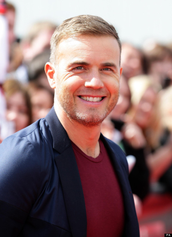 Gary Barlow Hair Loss