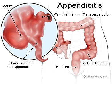 Human Appendix Location