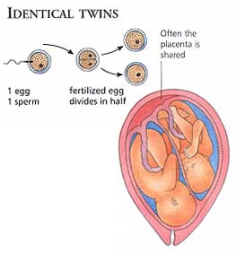 Identical Twins Pregnancy