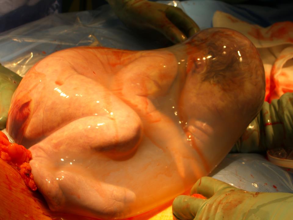 Images Of Babies Being Born