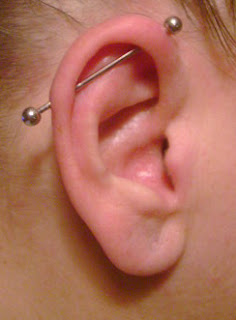 Industrial Piercing Infection