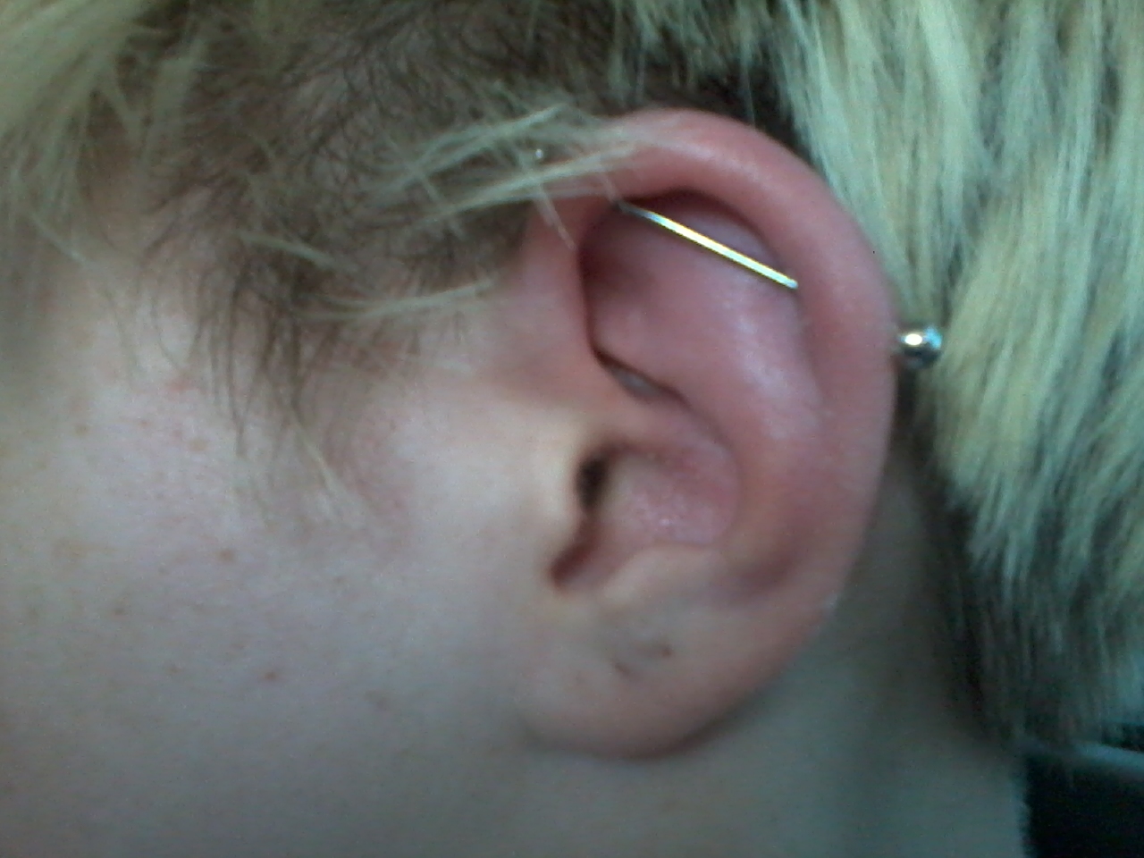 Industrial Piercing Infection