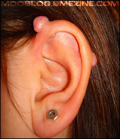 Industrial Piercing Infection