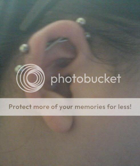 Industrial Piercing Infection Pictures