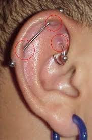 Industrial Piercing Infection Rate