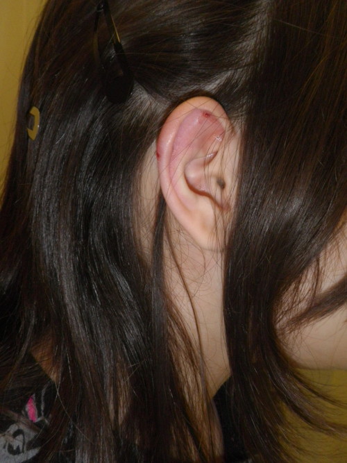 Industrial Piercing Infection Signs