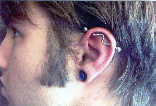 Industrial Piercing Infection Signs