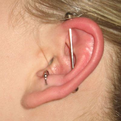 Industrial Piercing Infection Signs