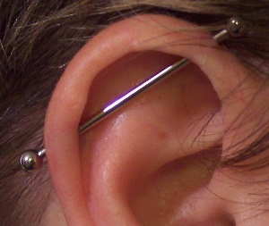 Industrial Piercing Infection Treatment