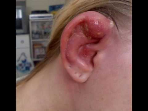 Industrial Piercing Pictures