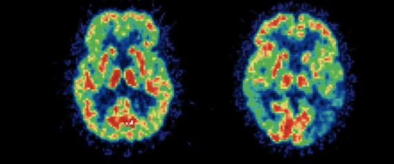 Lifestyle Diseases And Behavioral Risk Factors