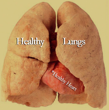 Lungs After Smoking